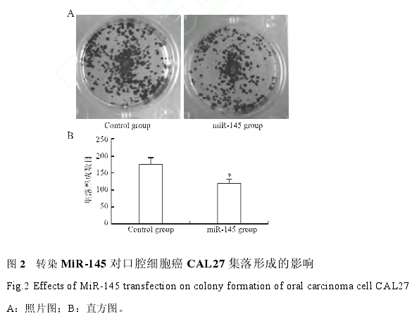 תȾ MiR-145 Կǻϸ CAL27 γɵӰͼ