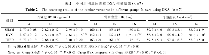 ͬ׵ DXA ɨ