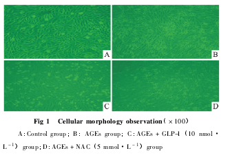 Fig 1 Cellular morphology observation  100A: Control group; B: AGEs group; C: AGEs + GLP-1  10 nmolL- 1 group; D: AGEs + NAC  5 mmolL- 1 group
