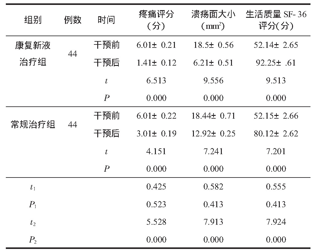 2 2 ԤǰǻʹСS F-36ֱȽ (s)