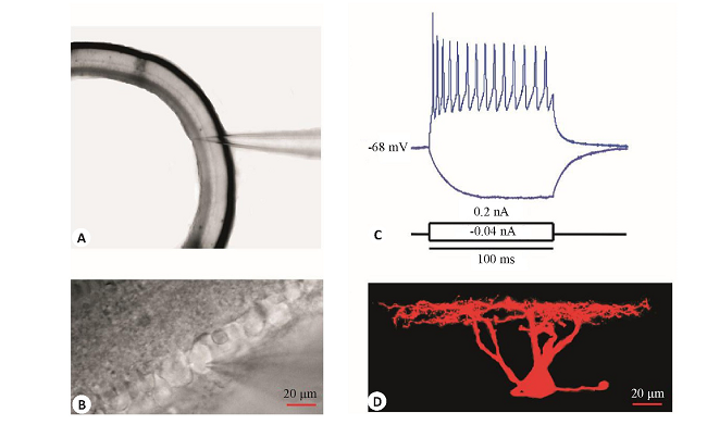 ͼ1 RGCļ¼̬ͼFig.1 Electrophysiological recording and identity of RGC.A:A coronal slice of the RGCs (Original magnification:4) showing the recorded ganglion layer in the innermost part of the retina;B:Typical RGCs for whole-cell recording (40) .The RGC layer is neatly arranged with large cell bodies (about 20m) ;C:A sketch map of action potential with a 100 ms stimulation interval in current clamp.The action potential threshold current of this RGCs is 0.04 n A, and the graph shows the action potential recorded at an injection current of 0.2n A;D:Morphology of a RGC with bio-cytin staining, highlighting dendrites and axons that extend outward.