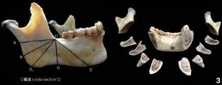 ͼ3 5߷ǽͼFig.3 Five line mandibular anatomy