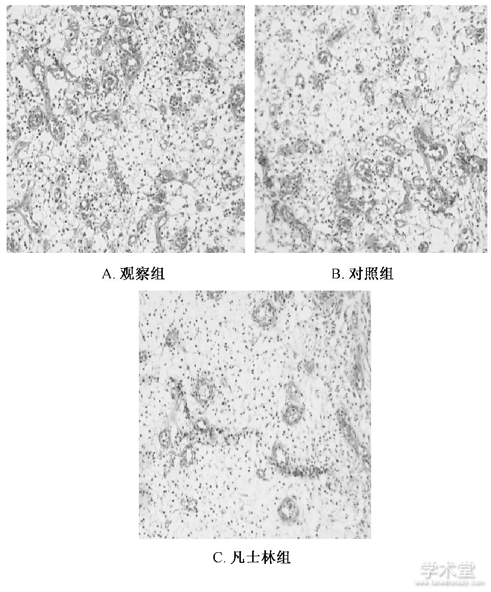 ͼ2 3ëϸѪȽ (200) Fig.2 Comparison of blood capillary counts among the three groups (200)