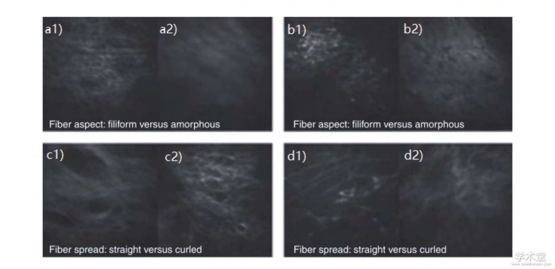 ͼ9 ͬά̬ĶӲͼԱ (:SHGź;:Էӫź) [19]Fig.9 Contrast of different fiber morphology MPT images (left:SHG signal;right:auto-fluorescence signal) [19]