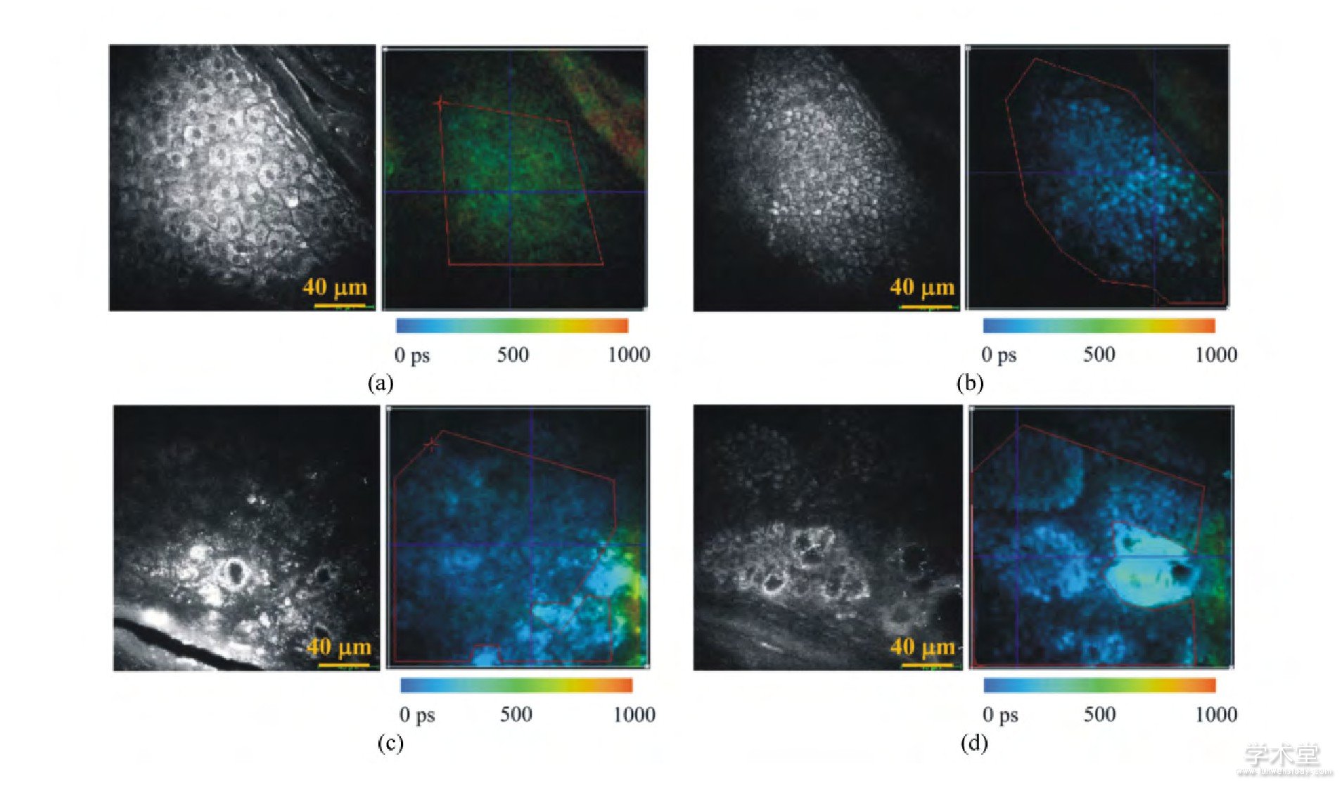 ͼ5 ͬƤ֯ԷӫǿӰӫӰԱ.־Ըߵ: (a) 㡢 (b) ײ;־Ըߵ: (c) 㡢 (d) ײ[16]Fig.5 Contrast of auto-fluorescence intensity maps and lifetime color maps:Asian volunteer's (a) stratum granulosum; (b) stratum basal;African volunteer's (c) stratum granulosum; (d) stratum basal[16]