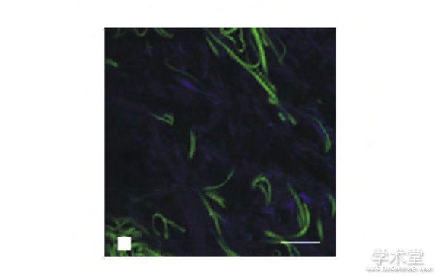 ͼ4 ƤнԭάSHGź () 뵯ԵάԷӫź () [14]Fig.4 SHG signal of collagen fibers (blue) and autoflu-orescence signal of elastic fibers (green) in the dermis (Scale bar:20m) [14]