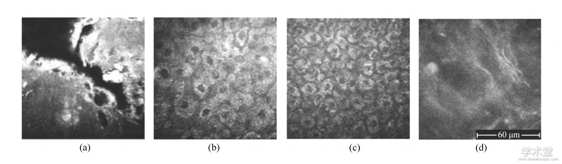 ͼ2 Ƥ, Ⲩ760 nm: (a) ʲ, 0m:ǵԷӫź; (b) , 20m:ϸе͸ʿNADPHǵԷӫź; (c) , 30m:ϸܶ;Ⲩ800 nm; (d) Ƥ, 85m:ԭסԵԷӫź[11]Fig.2 In vivo healthy human skin imaging with excitation wavelength of 760 nm: (a) Stratum corneum, 0m depth:auto-fluorescence signal of keratin; (b) Stratum granulosum, 20m depth:auto-fluorescence signal of keratohyalin gran-ules, NADPH, and keratin in keratinocytes; (c) Stratum spinosum, 30m depth:increased cellular density of ke-ratinocytes;800 nm excitation wavelength: (d) Dermis, 85m depth:auto-fluorescence signal of collagen and elas-tin[11]