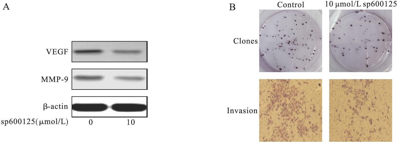 ͼ4 JNKƼsp600125KBϸVEGFMMP-9׵ı(A)ԼKBϸļγɺϮ(B)Ӱ(ᾧϡ100)